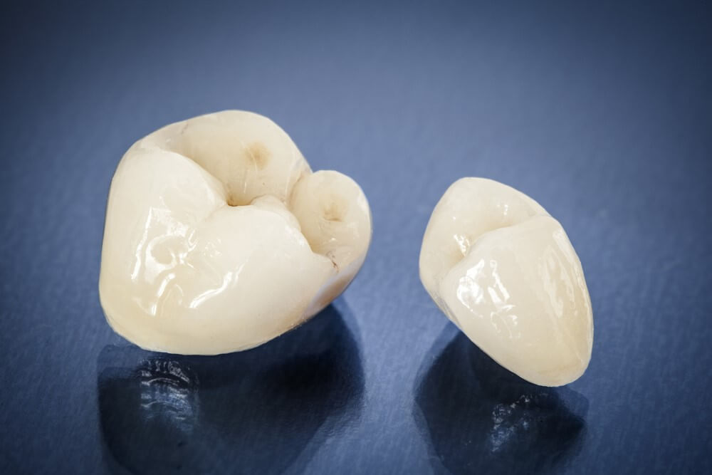 Porcelain dental crowns