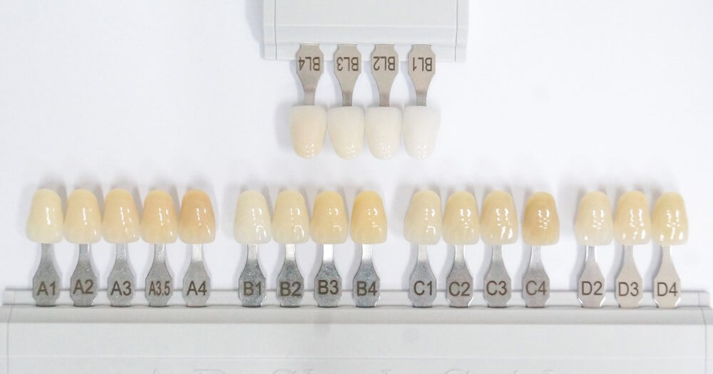 درجات ألوان أسنان الزيركون