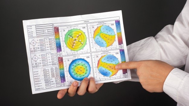 Keratoconus symptoms