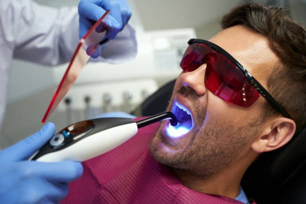 علاج تسوس الاسنان الامامية بالليزر