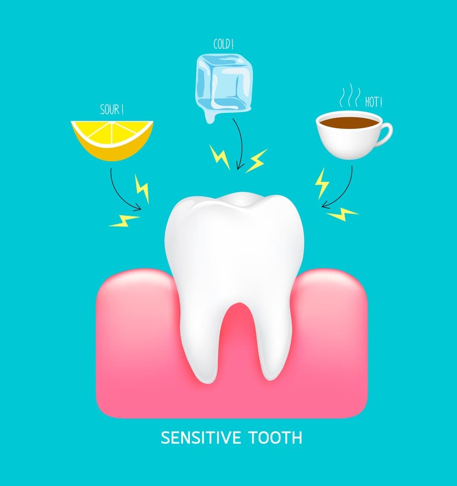 What does sensitive teeth mean