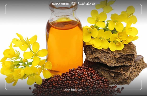 علاج الثعلبة بزيت الخردل