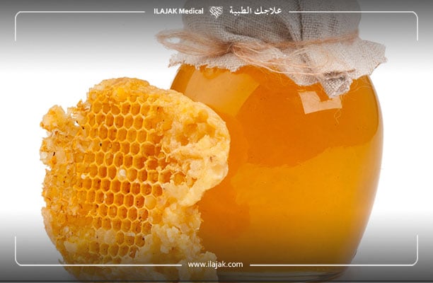 علاج الثعلبة بالعسل