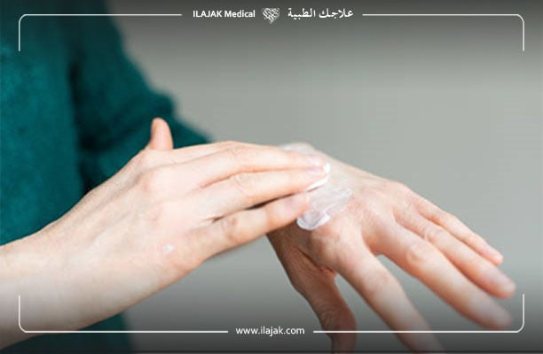 طرق علاج الاكزيما