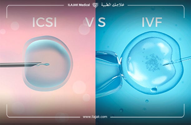 الفرق بين الحقن المجهري والتلقيح الصناعي