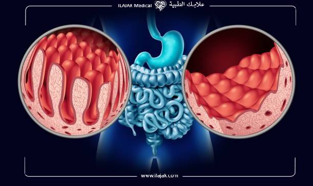 اسباب العقم عند الرجال