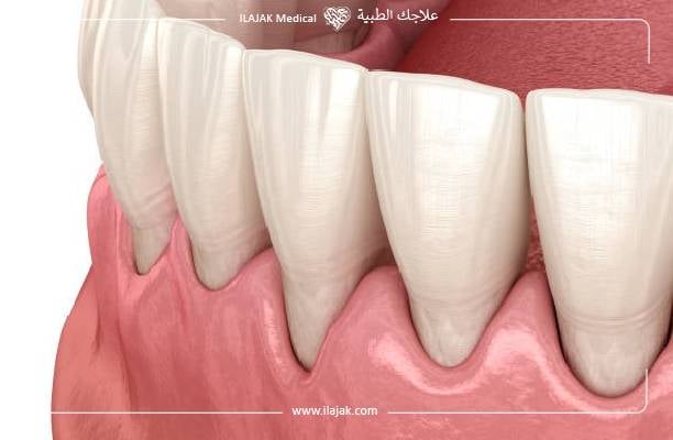 أمراض الأسنان واللثة 