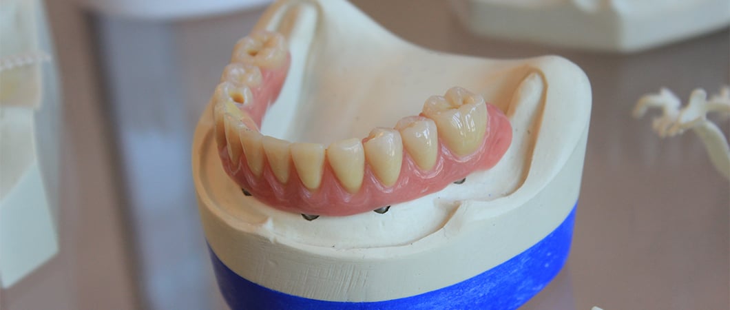 dental treatment in Turkey