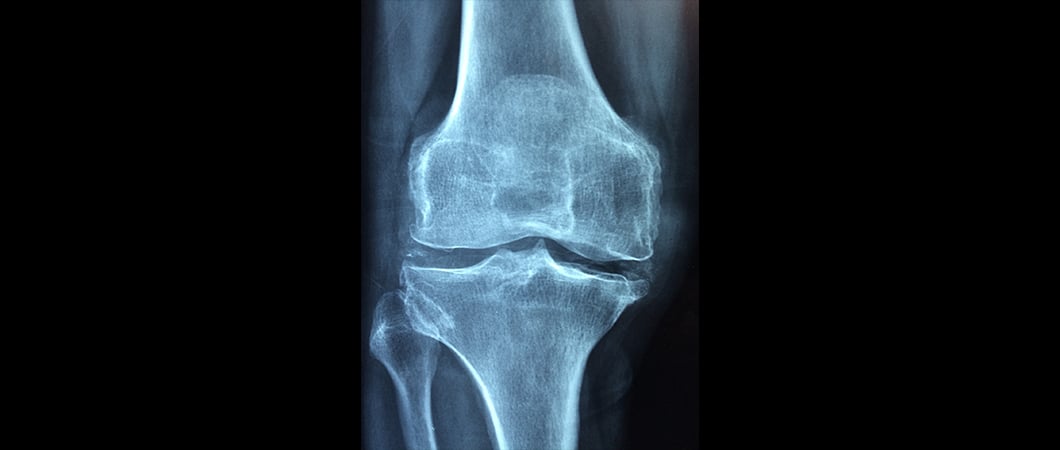 Hip and knee surgery 