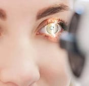 عملية الفيمتو ليزك: المميزات، المخاطر، والتكلفة