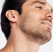 The potential side effects of beard transplantation