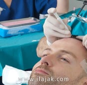 Hair transplant in Turkey are the cheapest and best 2024