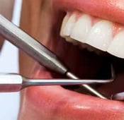 هل يمكن تجميل وتعديل الأسنان بدون تقويم؟