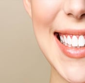 لصقات تبييض الأسنان: المزايا والعيوب والأسعار