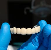 الفرق بين الفينير والزيركون: مقارنة من حيث الجودة والشكل والتكلفة