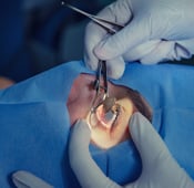طب و جراحة العيون في تركيا وتكاليفها 2025