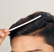 زراعة الشعر الصناعي: المميزات والتكلفة 2025