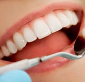 الحفاظ علي الأسنان: أهم العادات الصحية