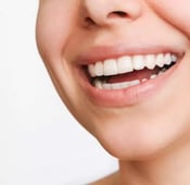 ابتسامة بوليود: هل هي الخيار الأمثل لأسنانك؟