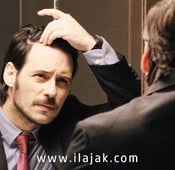 أفضل 10 طرق لعلاج الصلع عند الرجال