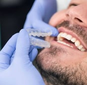 تقويم الاسنان الشفاف انفزلاين Invisalign : كيف يعمل وما هي أسعاره في تركيا؟