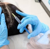Stem cell treatment for hair loss