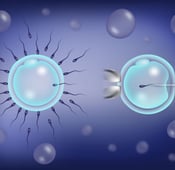 Comparison of IVF versus ICSI for treatment of infertility