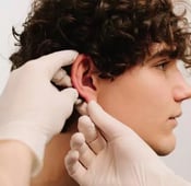 عملية تجميل الأذن في تركيا: دليل مفصّل 2025