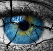 جفاف العين: الأعراض، الأسباب والعلاج