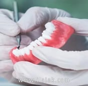 تقنيات علاج الاسنان في تركيا