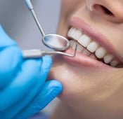 نزول اللثة وتعري الأسنان : الأسباب والعلاج