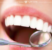 أفضل 5 طرق لتجميل الأسنان الكبيرة