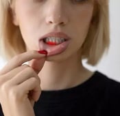 التهاب اللثة أثناء الحمل: الأسباب، الأعراض، والعلاج