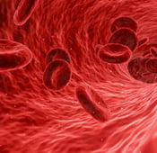 ما هي أسباب فقر الدم وما هي أهم أعراضه وطرق علاجه؟