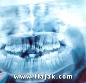 Dental treatment during coronavirus - Turkey