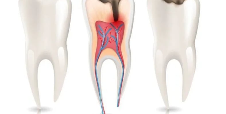 blog single image