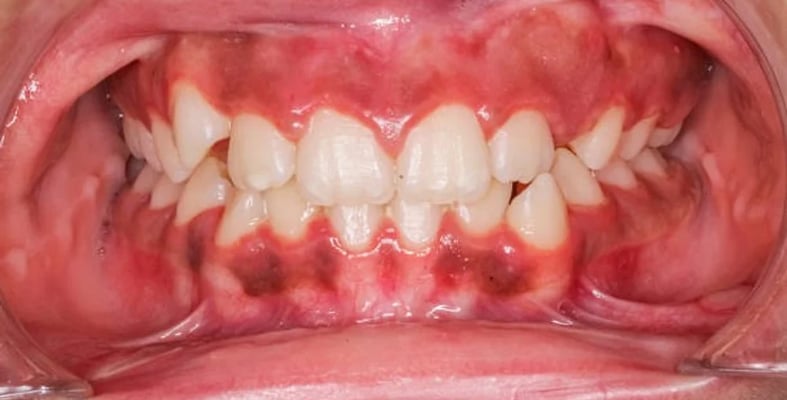 blog single image