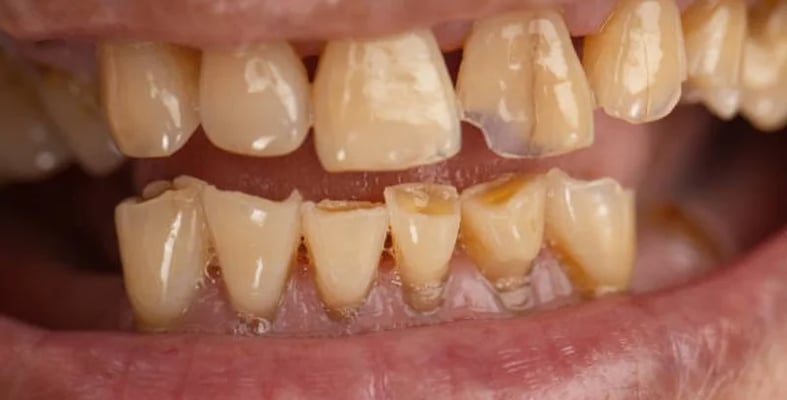 blog single image